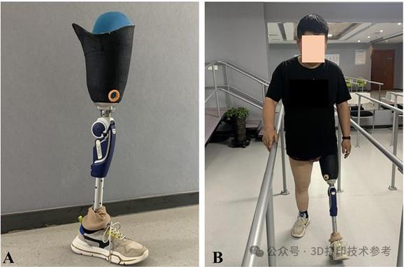 假肢3d手机价格-假肢3d手机价格多少